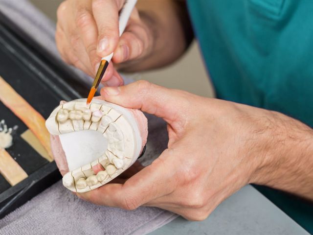 Técnico-em-Prótese-Dentária-1024x684